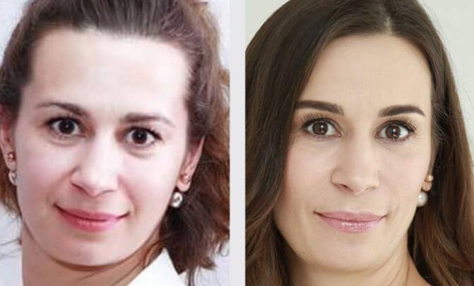 Прокачування особи: все, що потрібно знати про фейс-фітнесі