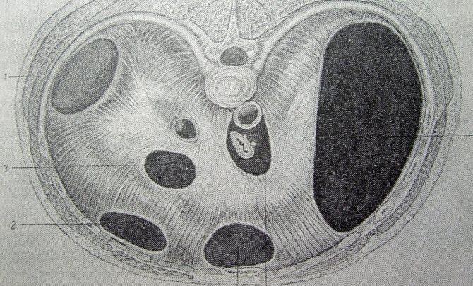 Методи лікування грижі стравоходу, симптоматика захворювання