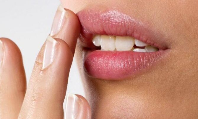 Губи уточкой: хвороба або синдром? Качині губи це призна до шизофренії або краса? Причини і позбавлення за допомогою операції + Фото