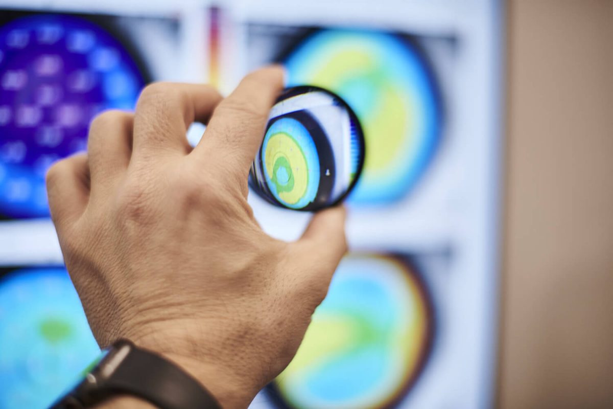 Вплив лазерного світла на оч