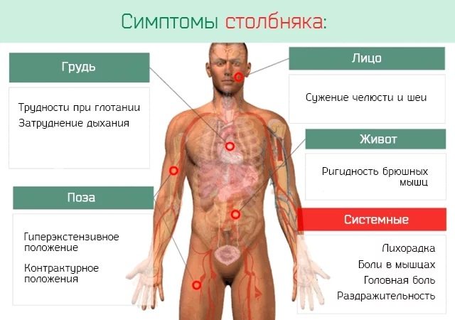 АДСМ щеплення.  Розшифровка дорослим, дітям.  Куди, від чого роблять, графік, наслідки