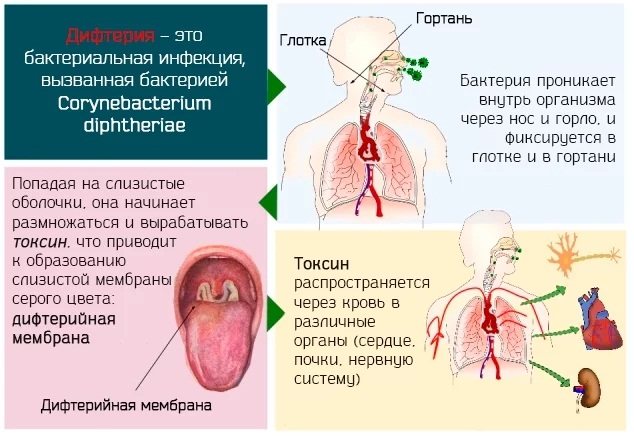 АДСМ щеплення.  Розшифровка дорослим, дітям.  Куди, від чого роблять, графік, наслідки