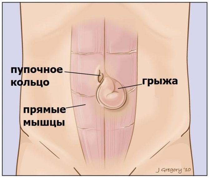 Анатомія пупкового кільця