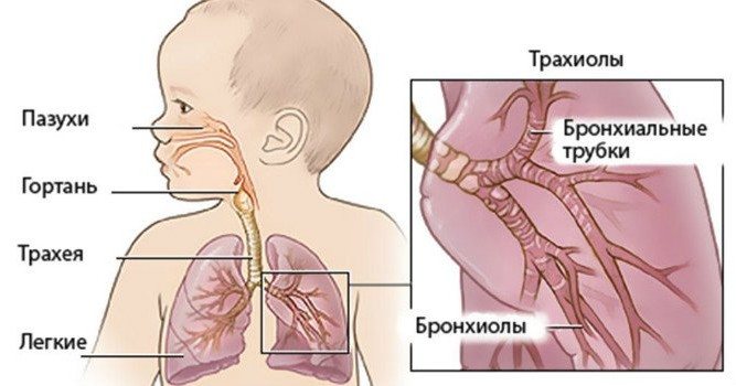 Бронхиолит і обструктивний бронхіт у дітей