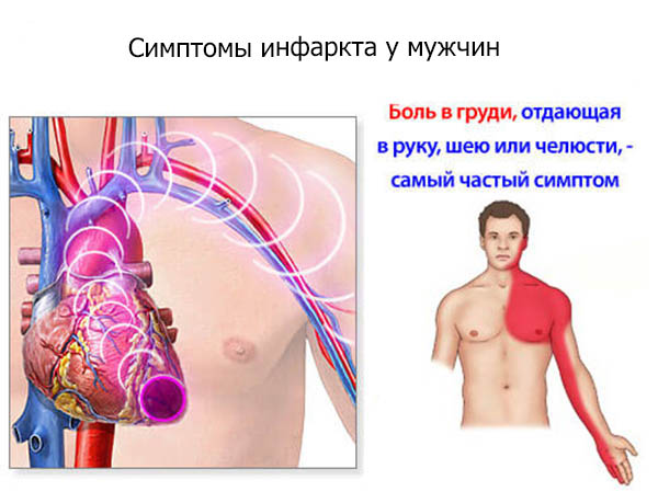 Часто спостерігається загрудинний біль, яку можна сплутати з болем в животі