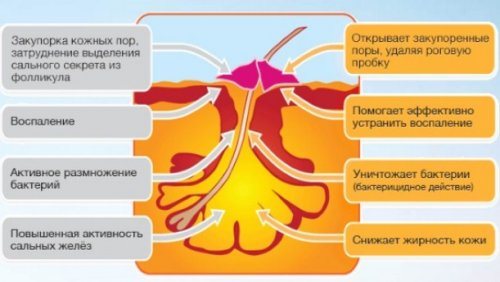 Дія препарату на запалену ділянку