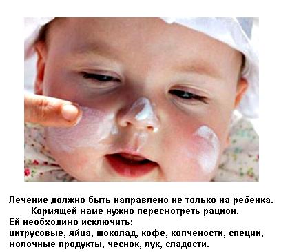 Діатез у новонароджених дітей: 4 групи, симптоми і ознаки, лікування і профілактика