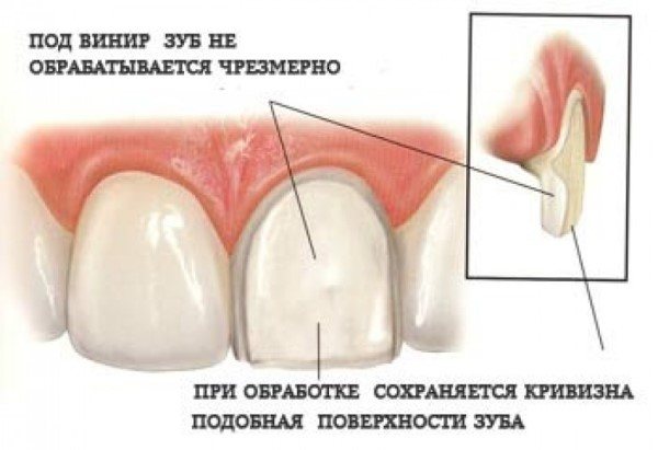 допустимі параметри