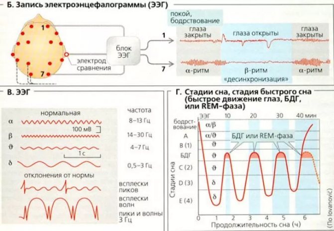 ЕЕГ головного мозку що показує розшифровка