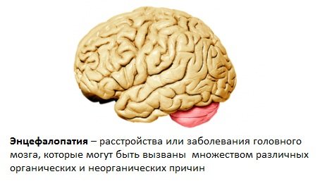 Види і методи лікування гідроцефалії головного мозку у дорослих