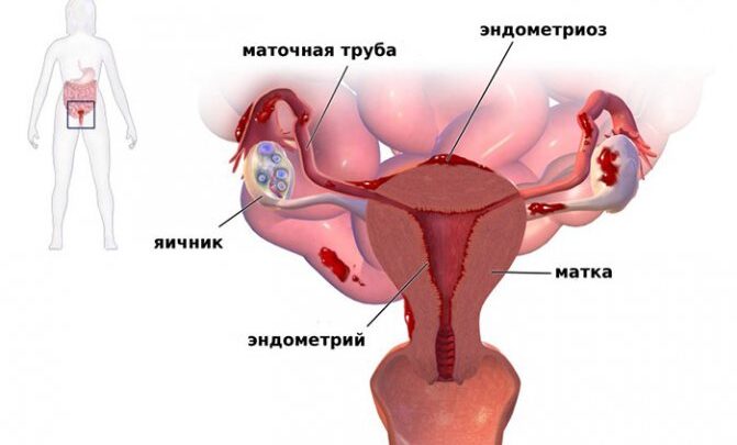 Тонус матки на різних термінах вагітності: як уникнути серйозних ускладнень
