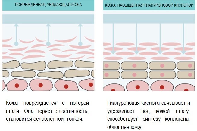 Ендоскопічний ліфтинг чола і брів.  Фото до і після, як виконується, наслідки, відгуки