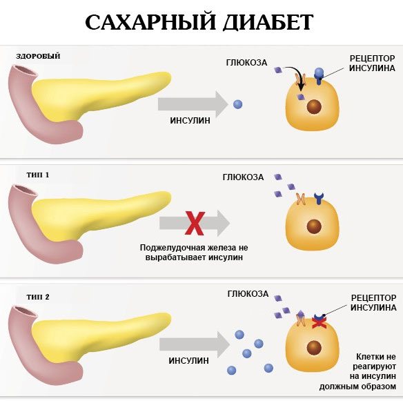 Ендоскопічний ліфтинг чола і брів.  Фото до і після, як виконується, наслідки, відгуки