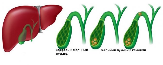 Якщо патологія протікає без ускладнень, то прогноз найчастіше сприятливий.