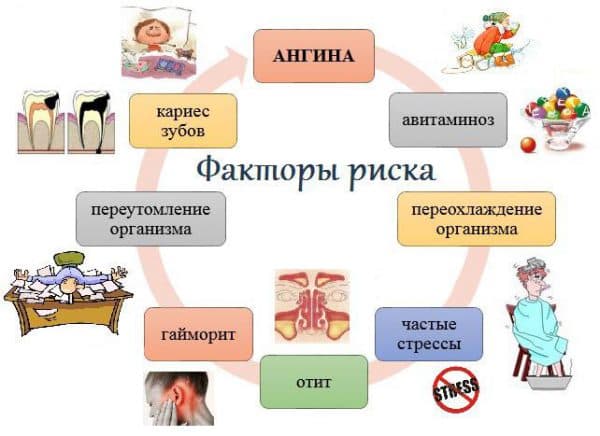 Фактори ризику захворювання на ангіну