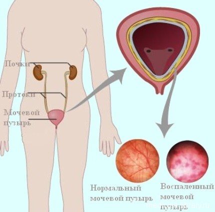 Форма випуску