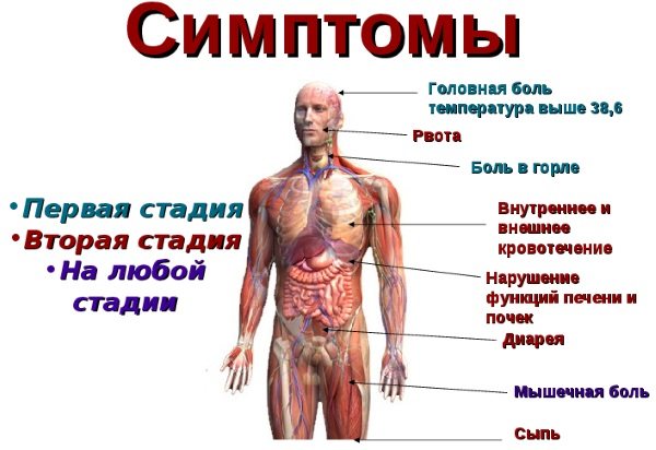 Геморагічна лихоманка.  Симптоми з нирковим синдромом, що це таке, лікування