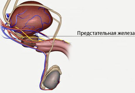 гіперплазія передміхурової залози