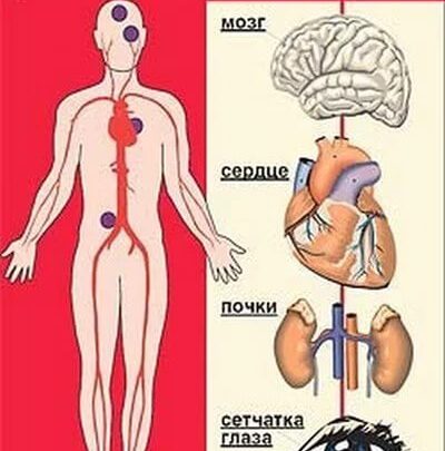 Гіпотонія причини появи симптоми і особливості лікування