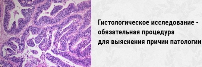 Ознаки вагітності, що завмерла на ранніх термінах – як реагувати на небезпечні симптоми?