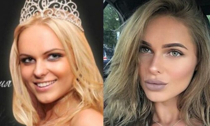 Ханна (співачка) до пластики і після неї. Біографія і особисте життя