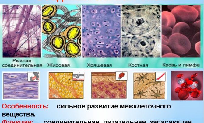 Дисплазія сполучної тканини у дітей: наслідки та їх лікування