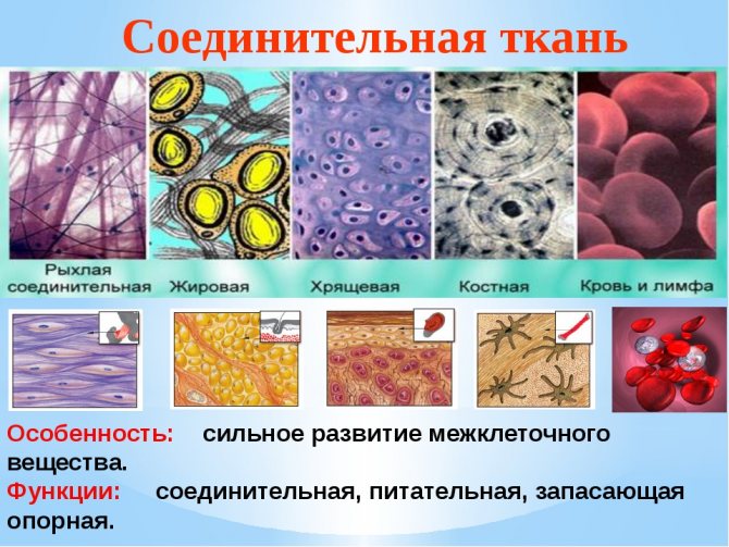 Дисплазія сполучної тканини у дітей: наслідки та їх лікування