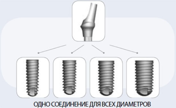 Імпланти антожір відгуки