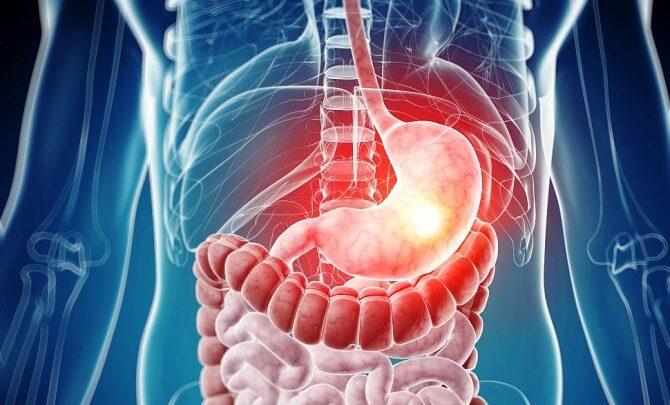 Цефтриаксон – інструкція із застосування, форма випуску, склад, показання, побічні ефекти, аналоги і ціна