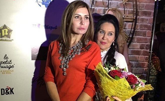 Ірина Агібалова – невдала пластична операція, фото до і після