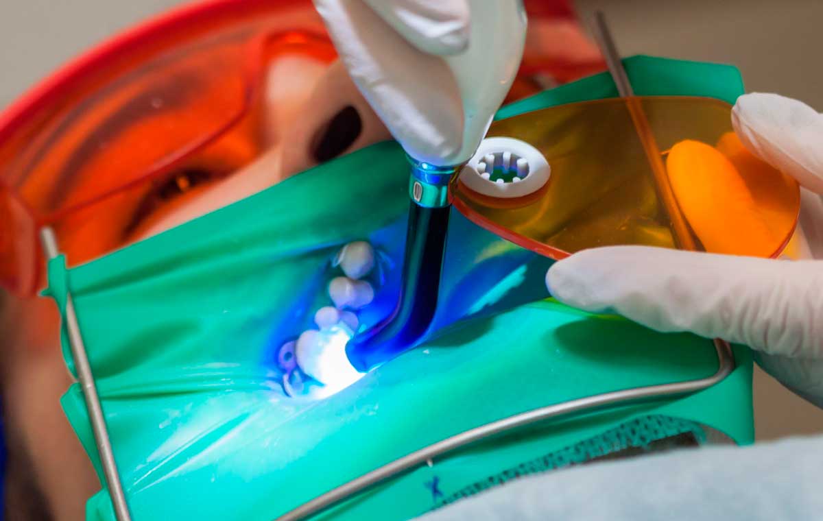 Безболезненная реставрация сильно разрушенного зуба пациента с использованием высоко-технологичного оборудования