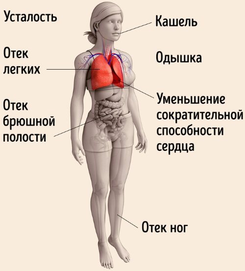 Ішемічна хвороба серця.  Симптоми і лікування, ознаки, рекомендації