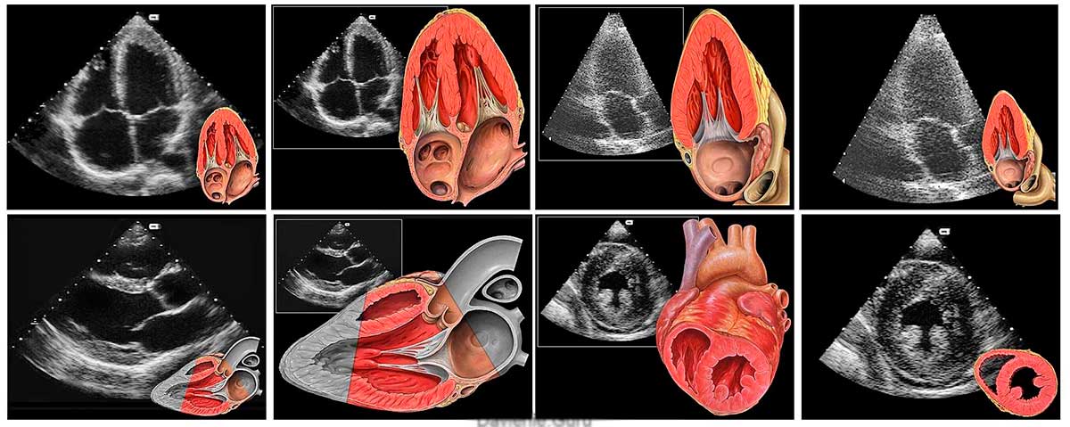 Що може показати УЗД серця