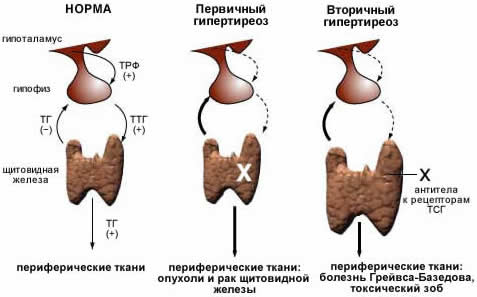 Як лікувати дифузне збільшення щитовидної залози 1-2 ст діагноз по УЗД