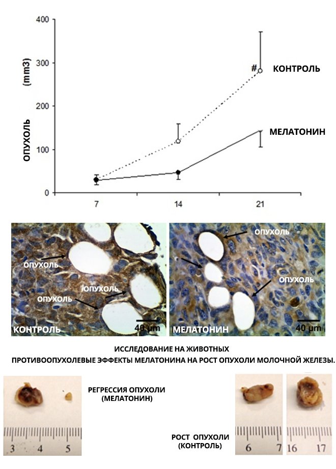 Мелатонин вред. Мелатонин гормон роста. Противоопухолевый эффект мелатонина. Регрессия опухоли молочной железы мелатонин. Мелатонин польза и вред.
