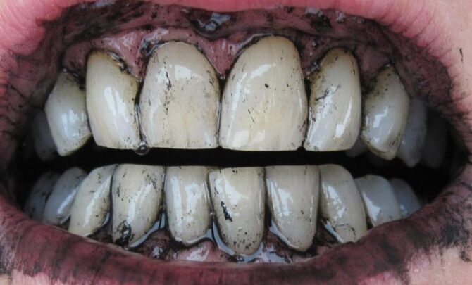 Гель для відбілювання зубів Aliexpress Teeth Whitening Pen Soft Brush Applicator For Teeth Whitening Dental Care Cheap Teeth whiter