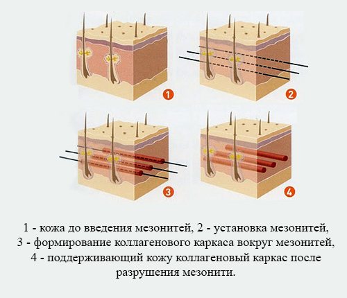 Як проходить процес і підготовка