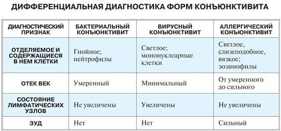 6 різновидів алергічного кон’юнктивіту і методи їх лікування