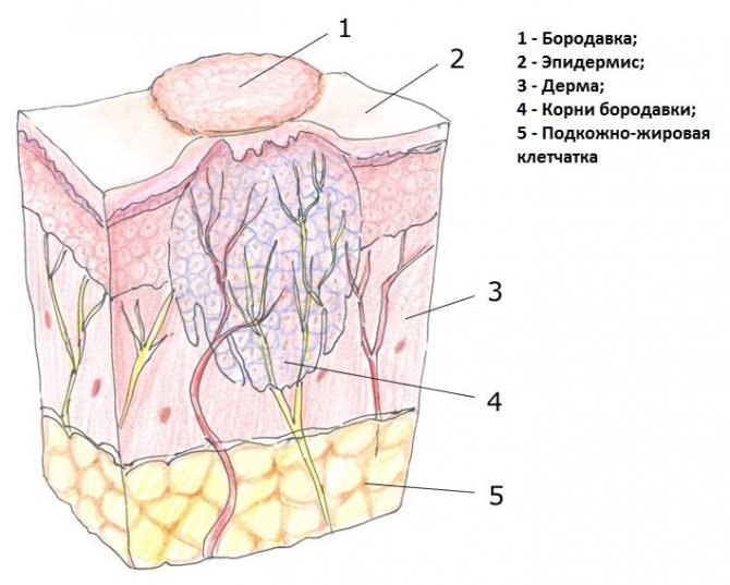 корінь бородавки