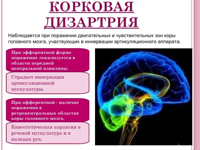 Дизартрія у дітей – що це? Стерта, псевдобульбарная, бульбарна, коркова дизартрія