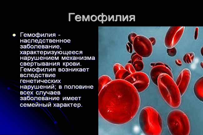 Кров в сечі при гемофілії