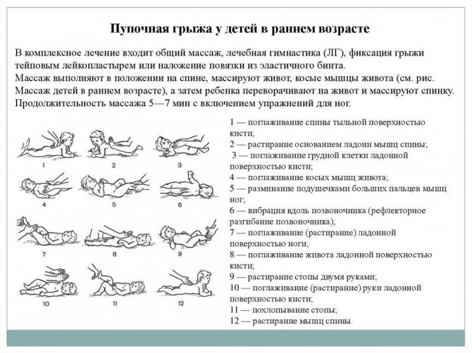 ЛФК при пупкової грижі у дітей