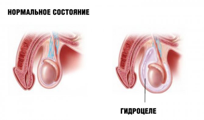 Механізм розвитку захворювання