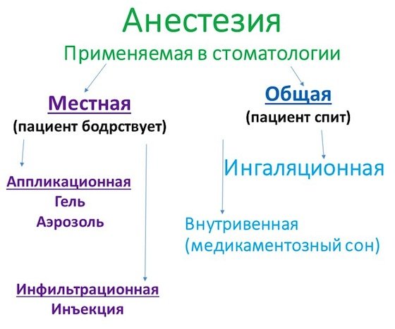 Місцева і загальна анестезія в стоматології