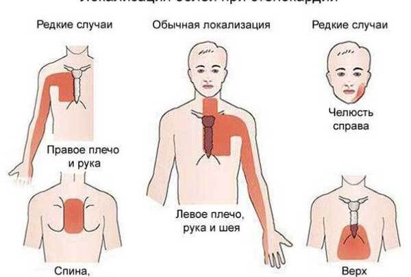 Чим відрізняється метопролол сукцинат від метопрололу тартрат