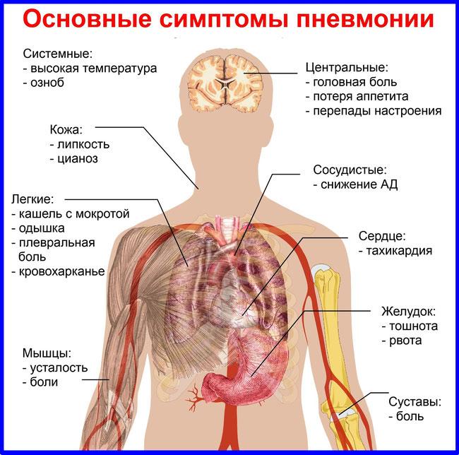 чи може пневмонія перерости в пневмококової інфекцію