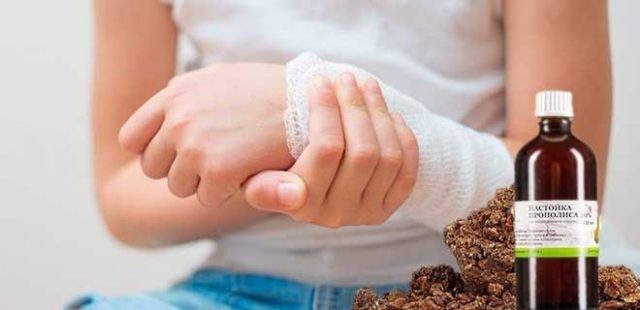 Настоянка прополісу для дітей: на спирту, як приготувати, як приймати для імунітету