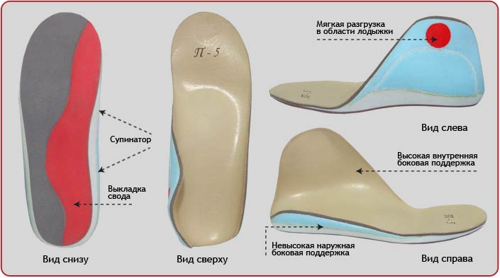 Особливості появи і лікування плосковальгусной стопи у дитини Особливості появи і лікування плосковальгусной стопи у дитини