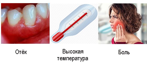 Ускладнення після розрізу ясна