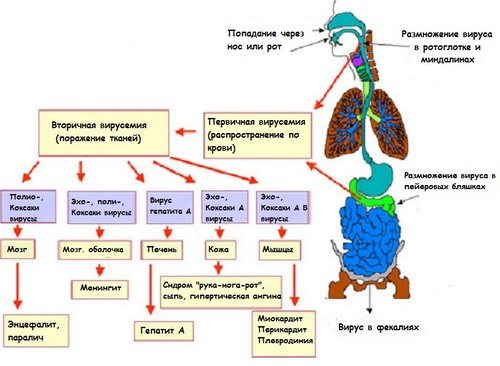 Патогенез ентеровірусної інфекції